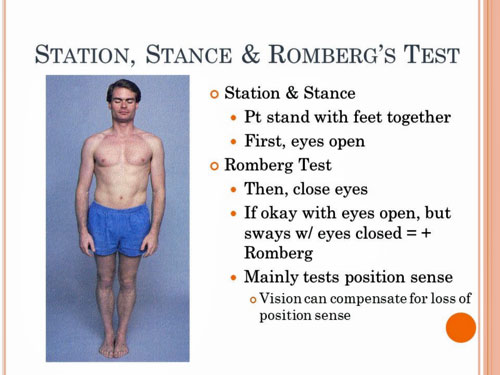 The Romberg Test